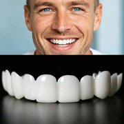 Kumamart Thermal Forming Moldable Snap On Teeth Covers, Reusable Adjustable UpperLower Oral Buffer Pad, 2Pair White
