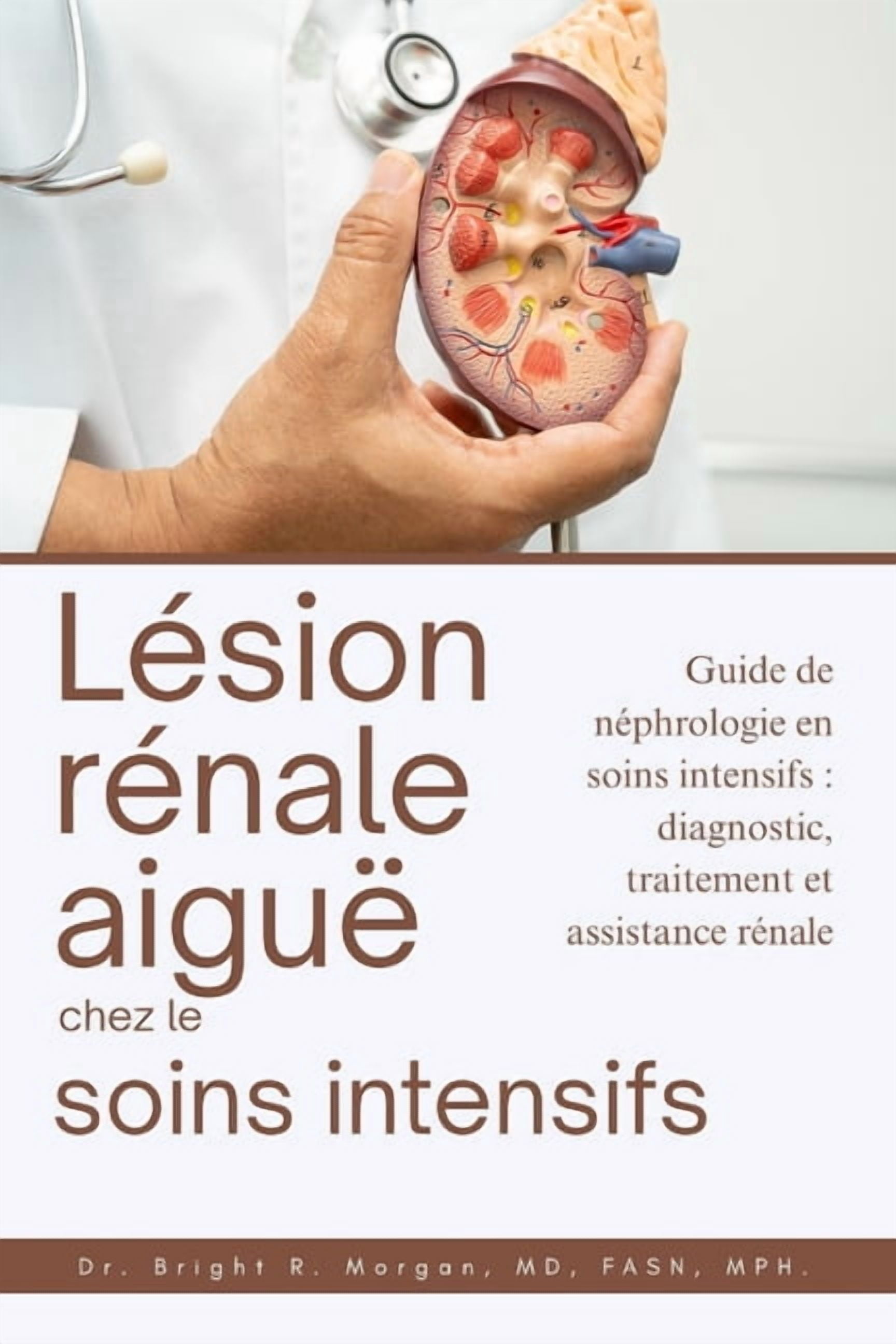 LÃ©sion rÃ©nale aiguÃ« chez lesoins intensifs: Guide de nÃ©phrologie en soins intensifs: diagnostic, traitement et assistanc, (Paperback)