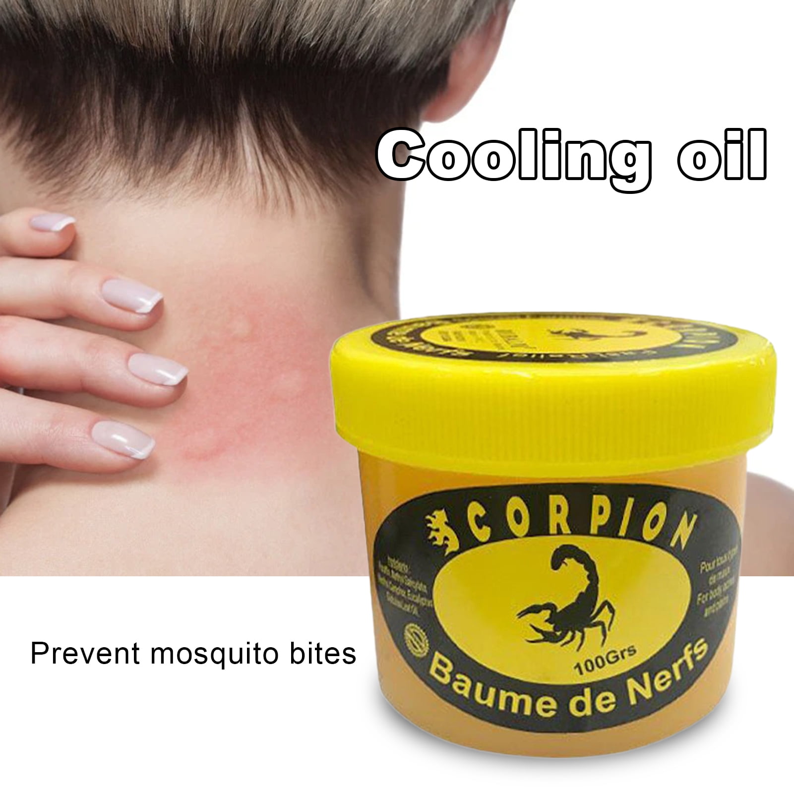 LA TALUS 100g Urticaria Cream Nonirritating Multifunctional Firstaid