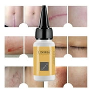 LAOSR Hyaluronic Organic Aging Wrinkle Acne Removal Face Essence Buy 2 Receive 3