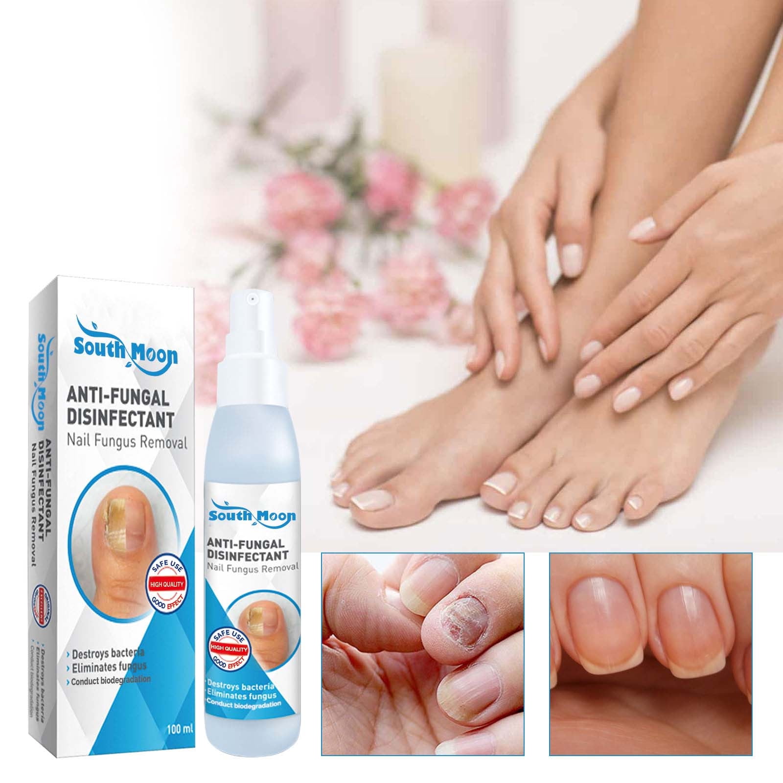 LEHOZIHEQ Deals Nail Repair Spray Repair And Clean Nails, Hands, Feet