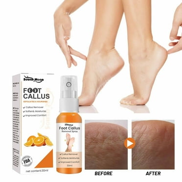 LEHOZIHEQ Professional Callus Remover for Feet, Instant Foot Peeling Spray, Exfoliating Foot Mask, Moisturizing & Smooth Dry, Cracked Heels, Remove Dead Skin Quickly, Cruelty-Free & Vegan