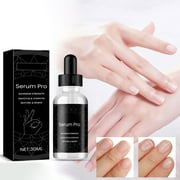LIANGP Beauty Products Nail Liquid Hand And Foot Grey Nail Shining Nail Thickening Toe Grey Nail Care 30ml Beauty Tools