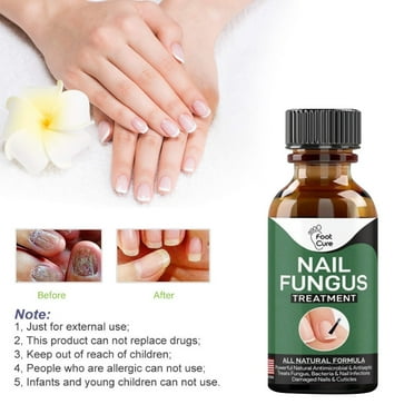 LILSHIM Nail Fungus Treatment Toe Anti Infection Nails Essence (50ml)