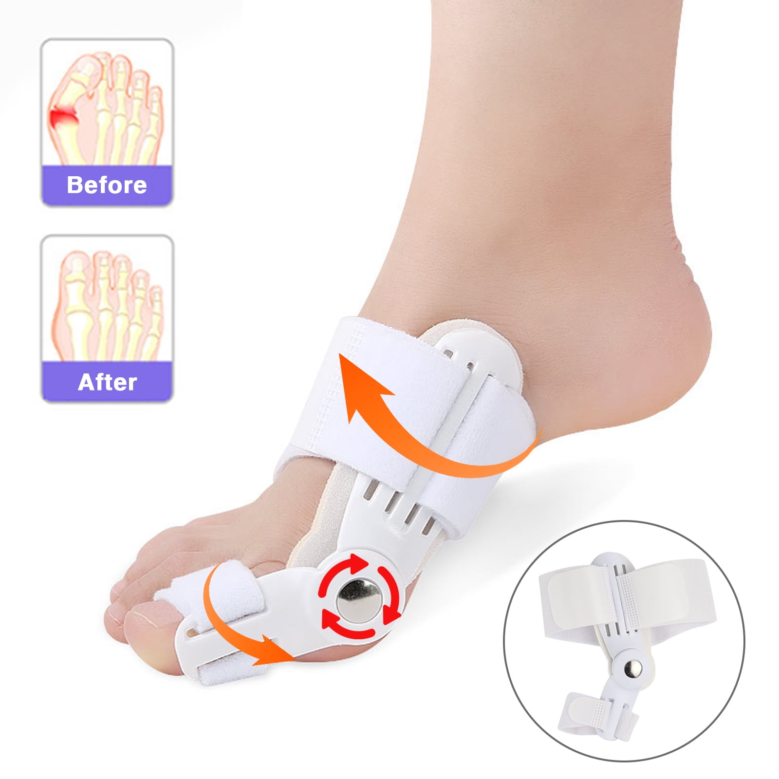 LITEYPP Bunion Correctors,1 Pair Toe Braces for Big Toe Toe Separator