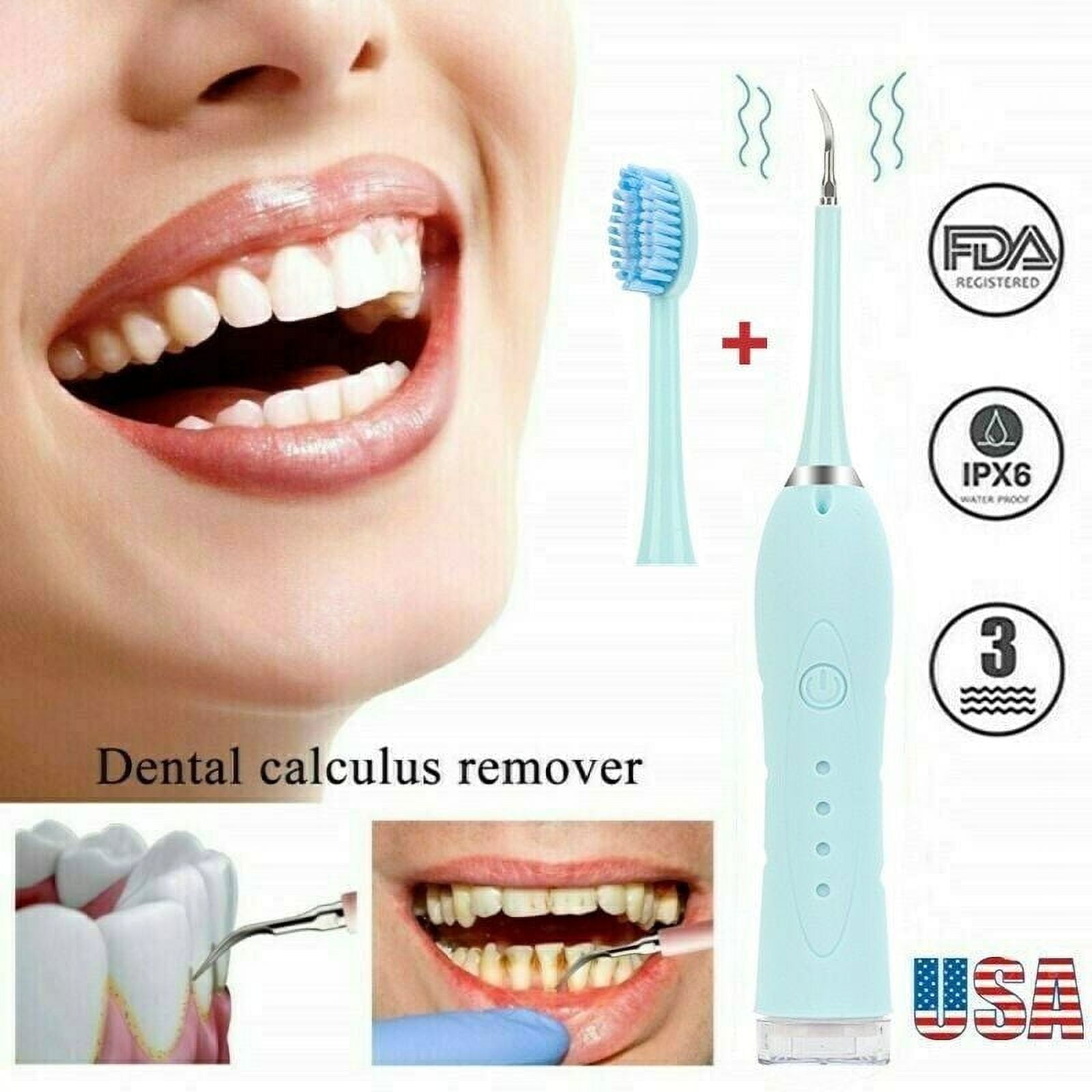 LNGOOR Portable Electric Ultrasonic Dental Calculus Remover Tool, High-Frequency Vibration Tooth Scraper Tartar Removal Cleaner,USB charging&5 Adjustable Speed Modes(Blue)