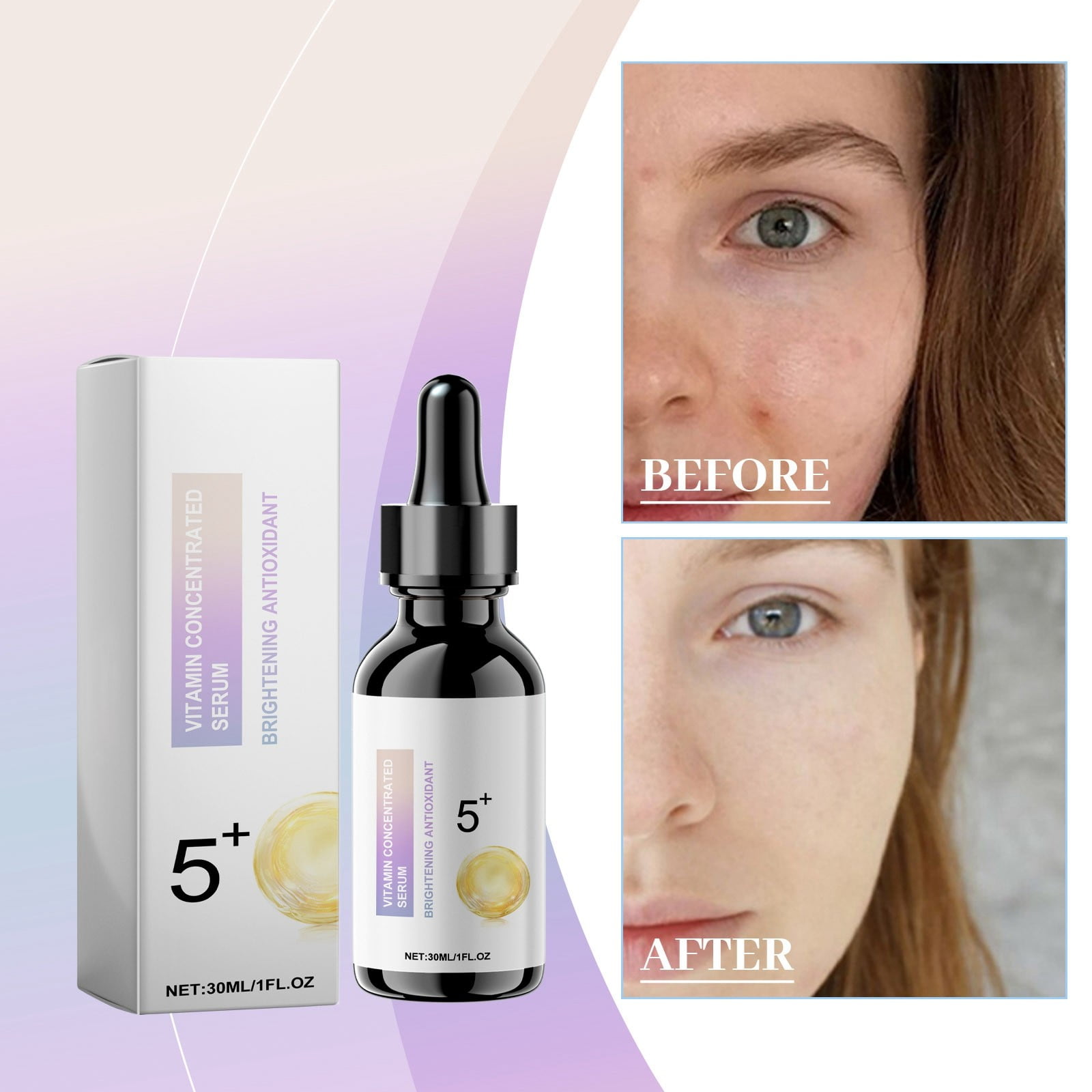 LUODU Plasma Pen Remover Eyebrow Threading Korean Skin Care Beauty for Dry Skin Face Peptide9