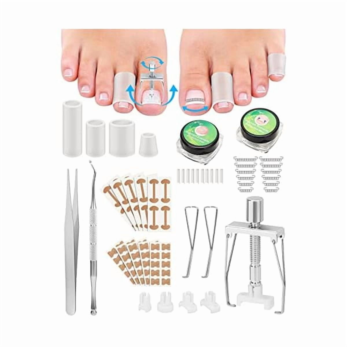 LYHIngrown Toenail Removal Kit, Ingrown Toenail Treatment, Ingrown Toenail Corrector Tools Come with Podiatry Toenail Braces, Ingrown Toenail Corrector Strips and Patch for Toe Pain Relief