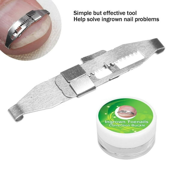 LYUMO Ingrowing Nail Corrector, Ingrown Toenail Correction Tool, Stainless Steel Ingrown Toenail Corrector Paronychia Treatment Correcting Tool