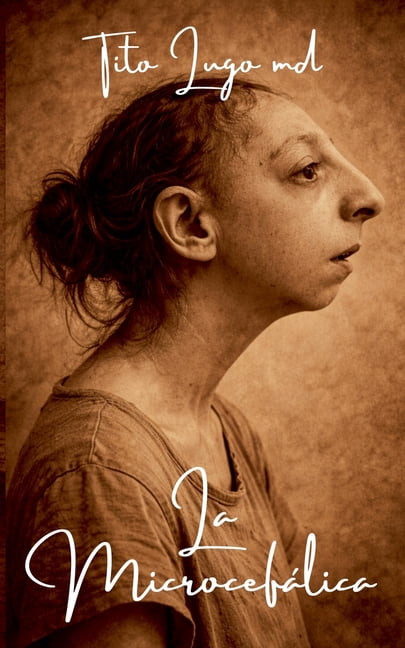 La MicrocefÃ¡lica, (Paperback)