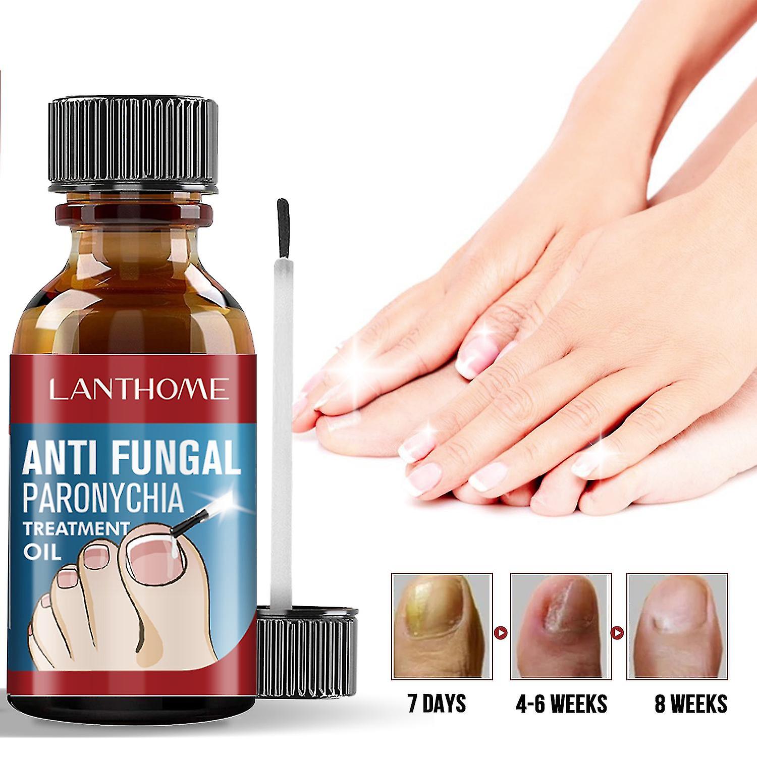 Lanthome Nail Fungus Treatment Essence Serum Hand And Foot Care Anti