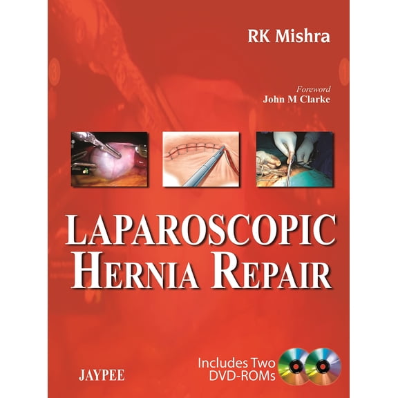 Laparoscopic Hernia Repair Include 2 DVD ROMs