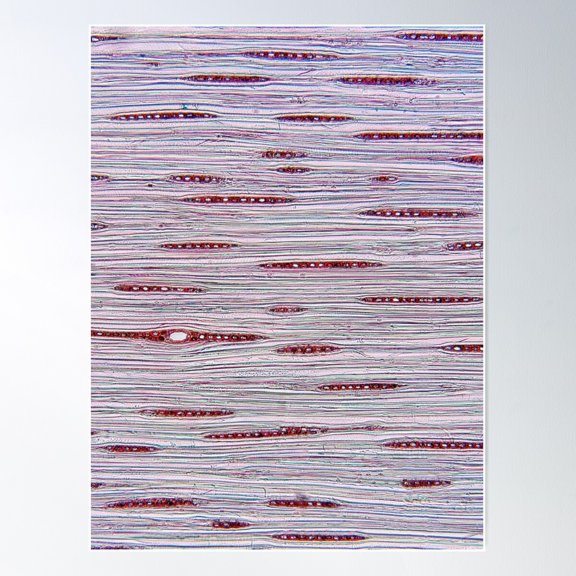 Larch Tree, Wood Cells; Plant Anatomy, Microscopy Poster Wall Art, Modern Wall Decor For Living Room Bedroom, 16x24 UNFRAMED