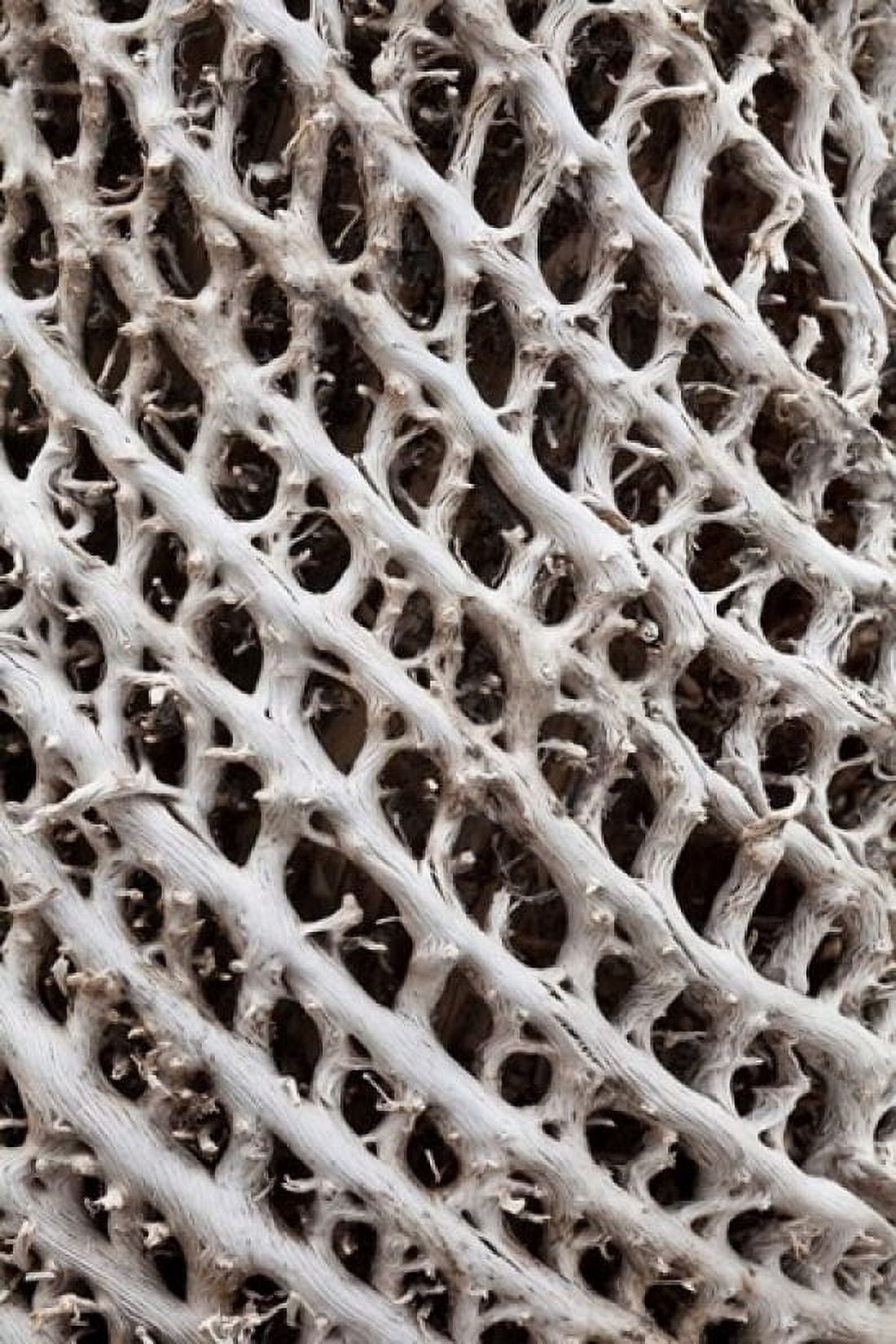 Lattice pattern in Giant Loebelia Bale Mountains Ethiopia Canvas Art - Martin Zwick DanitaDelimont (25 x 38)