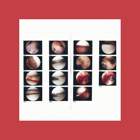 Cradle - Laughing In My Sleep (co - Music & Performance - Vinyl