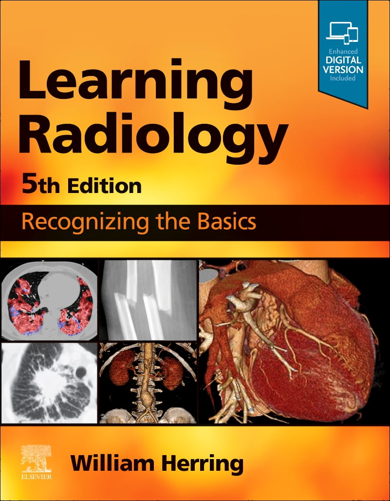 Learning Radiology - Walmart.com