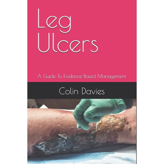 Leg Ulcers Leg Ulcers: A Guide To Evidence-Based Management, (Paperback)