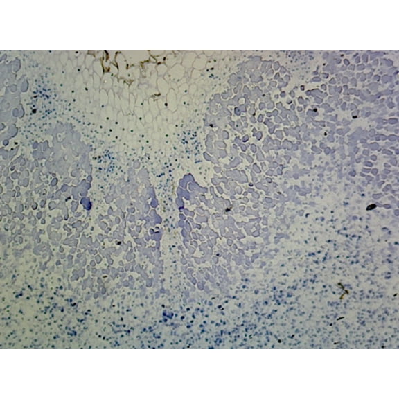 Legume Root Nodule; Section Showing Nitrogen Fixing Bacteria in the Nodules by Go Science Crazy