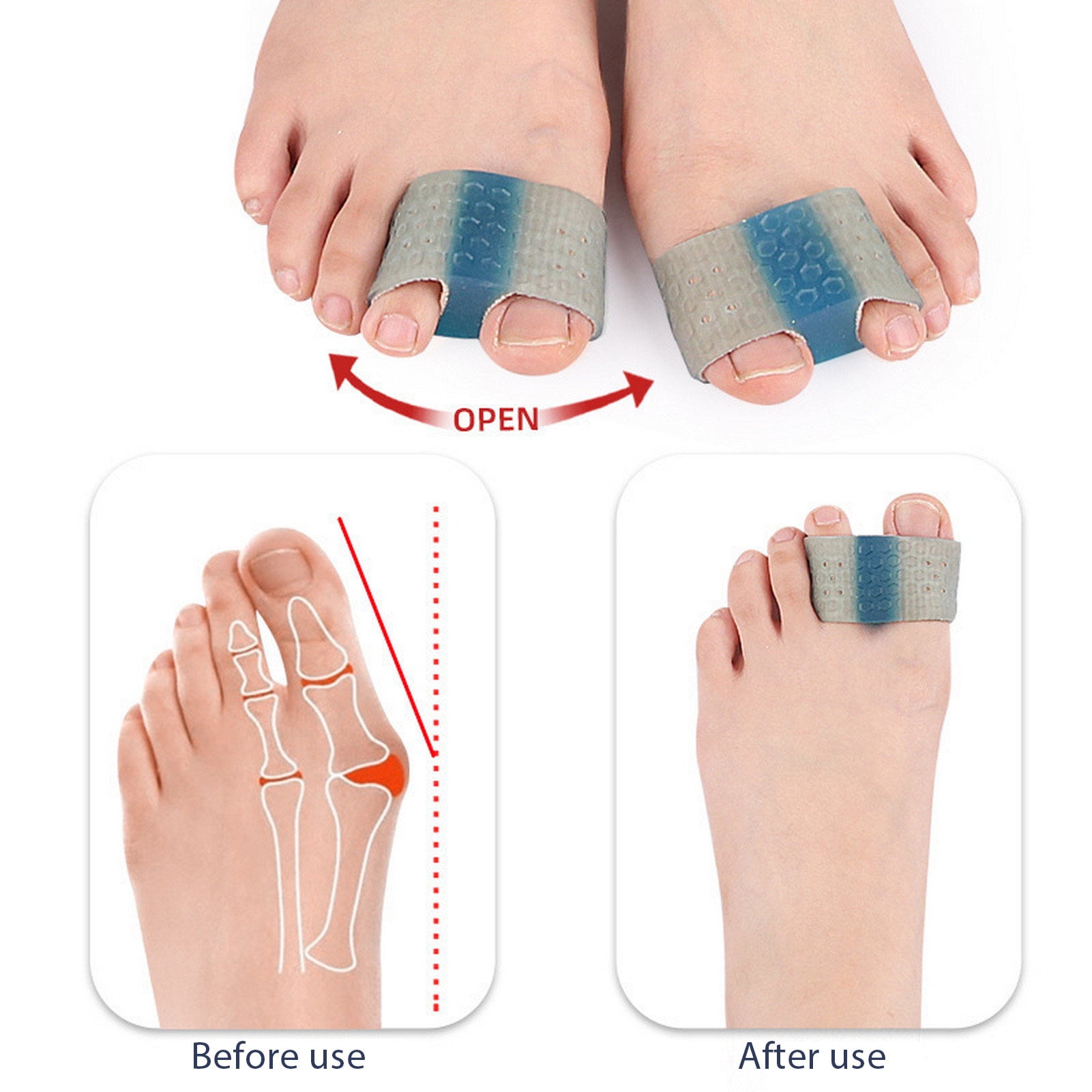 Lfhueenn SEBS Toe Separators Toe Separator Orthopedic Bunion Corrector