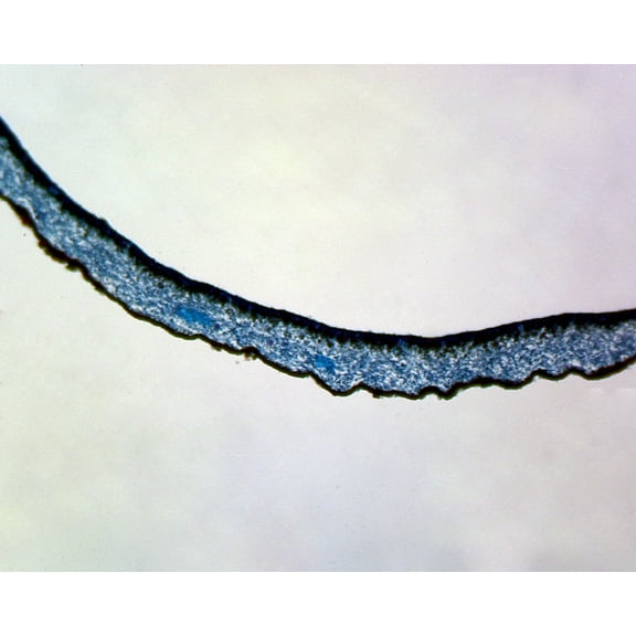 Lichen (Thallus Surrounded by Fungal Hyphae); Section by Go Science Crazy