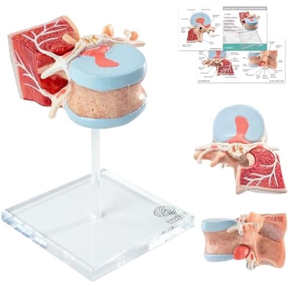 Life Size Human Lumbar Spine Model with Spinal Cord & Herniated Disc Showing L1 Disc Herniation Compressing Nerves, with Base and Manual for Medical & Biology Education Study$$Tools & Hardware Other