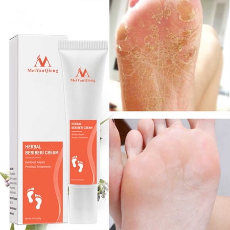 Ligghig 15ml Plantar Antifungal Foot Cream Organic, Infection Fungus Gel Repair Dry Crack Toe Treatment