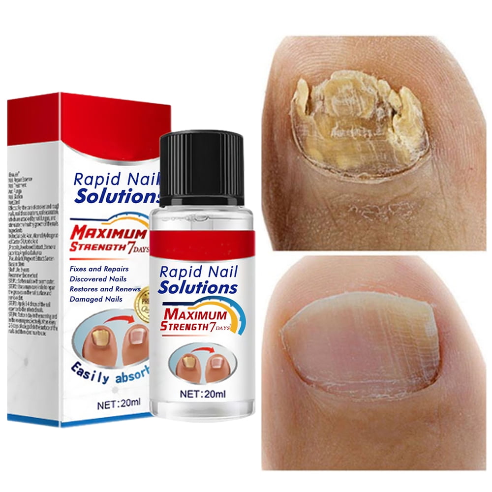 Ligghig Toenail Fungus Treatment Nail Repair Liquid for Toenail and