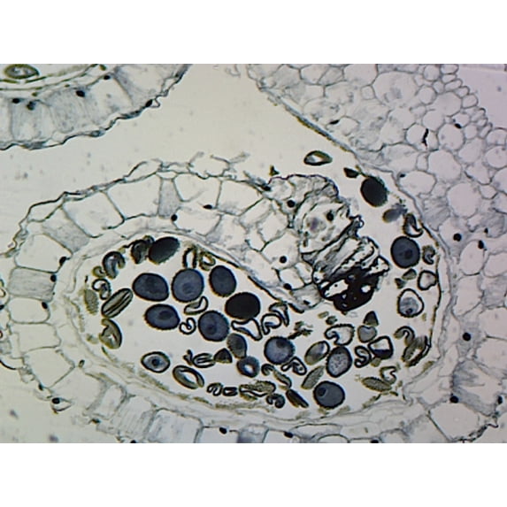 Microscope Slide Prepared - Lilium Anther, Showing Mature Pollen Grains; Cross Section