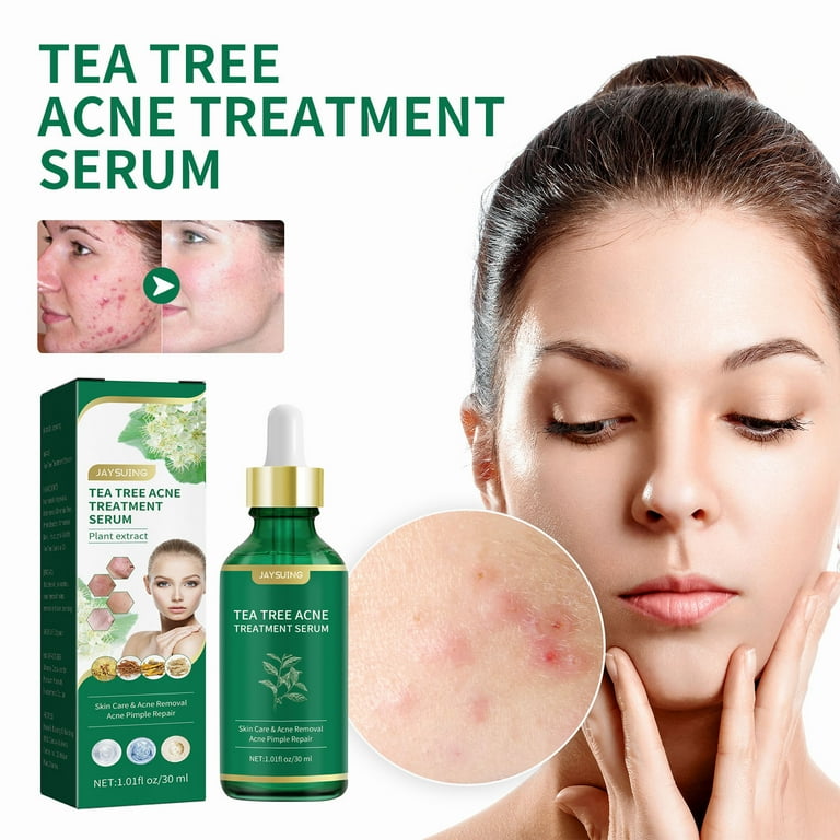 Lingouzi TeaTree Oil Serum Acne Cure For Prone Face Sensitive Skin Care Cystic Acne Pimples Scar Remover Redness Relief Niacinamide Facial Moisturizer 30ML Walmart