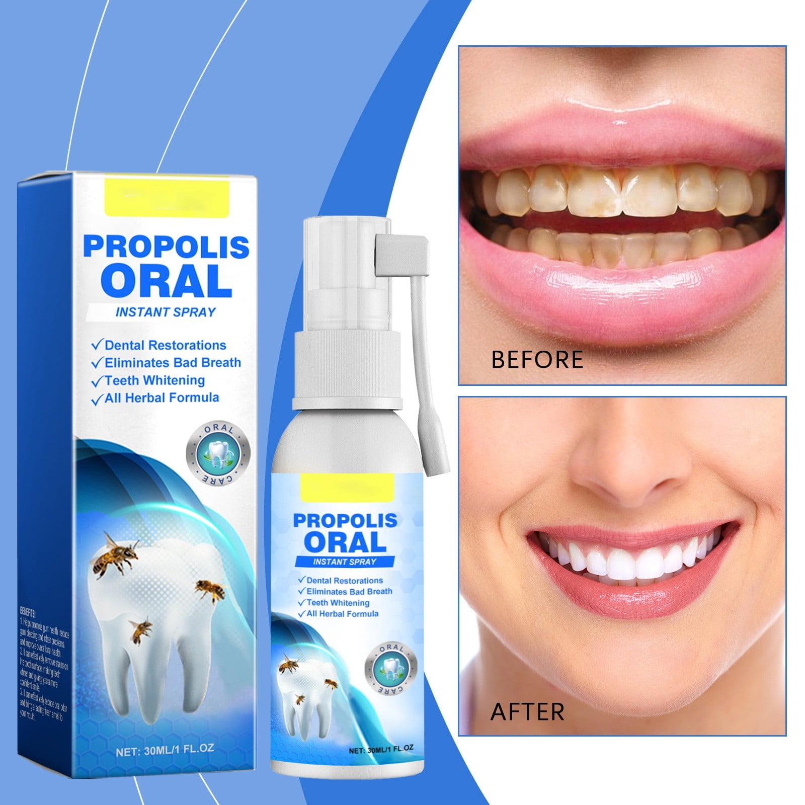 Linjieee Pimple Patch Oral Care Spray For Clean And White Teeth Long