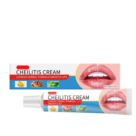 Lip Hydration,Lip Balm,Lip Moisturising Balm Dry And Chapped Lip Care Nourishing And Moisturising Gel,Lip Cream for Cheilitis,Cheilitis Lip Treatment Cream(20g/0.71oz)