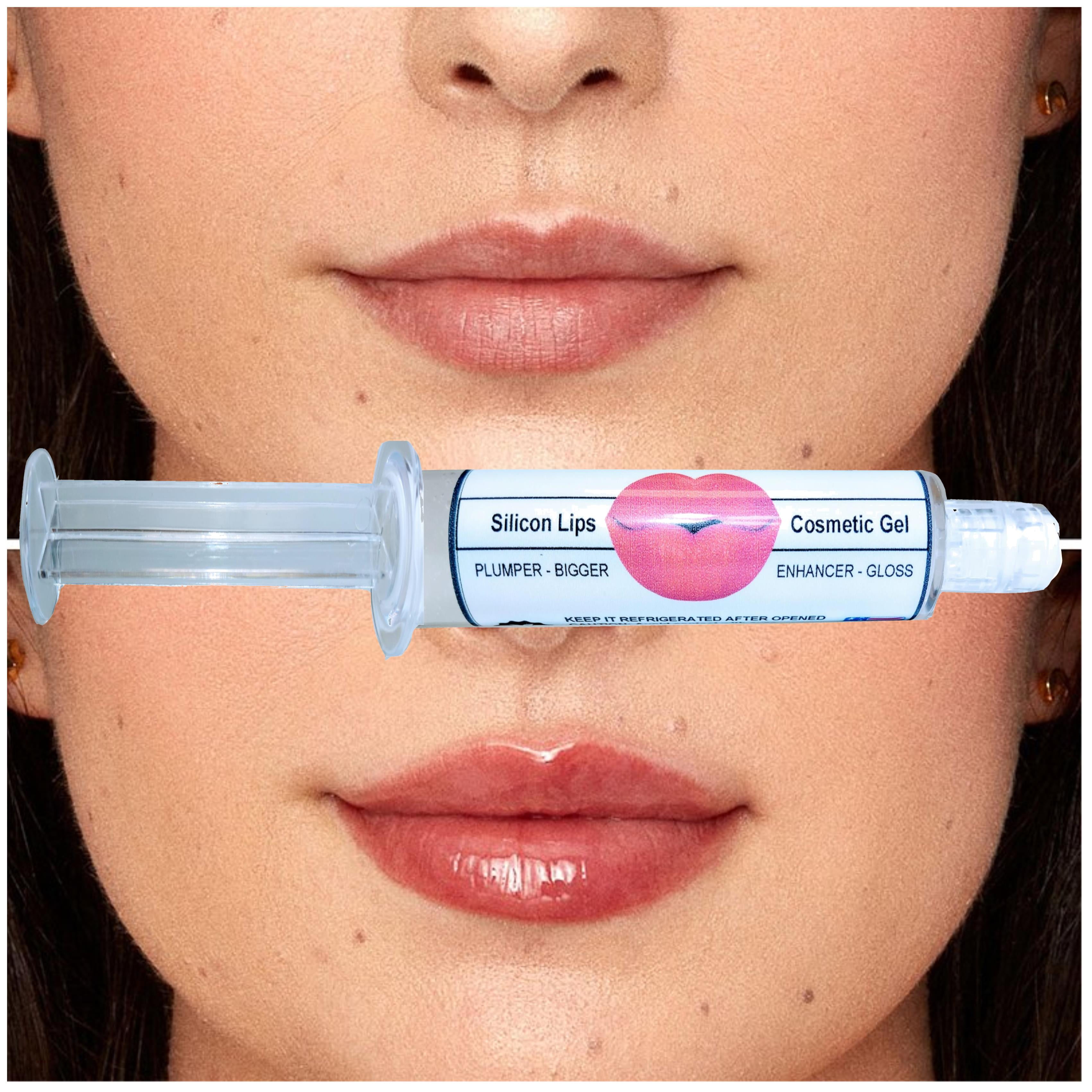 Lip Plumper Silicon Gel Cosmetic Enhancer Thickener With Hyaluronic Acid Needles Free By ALKA