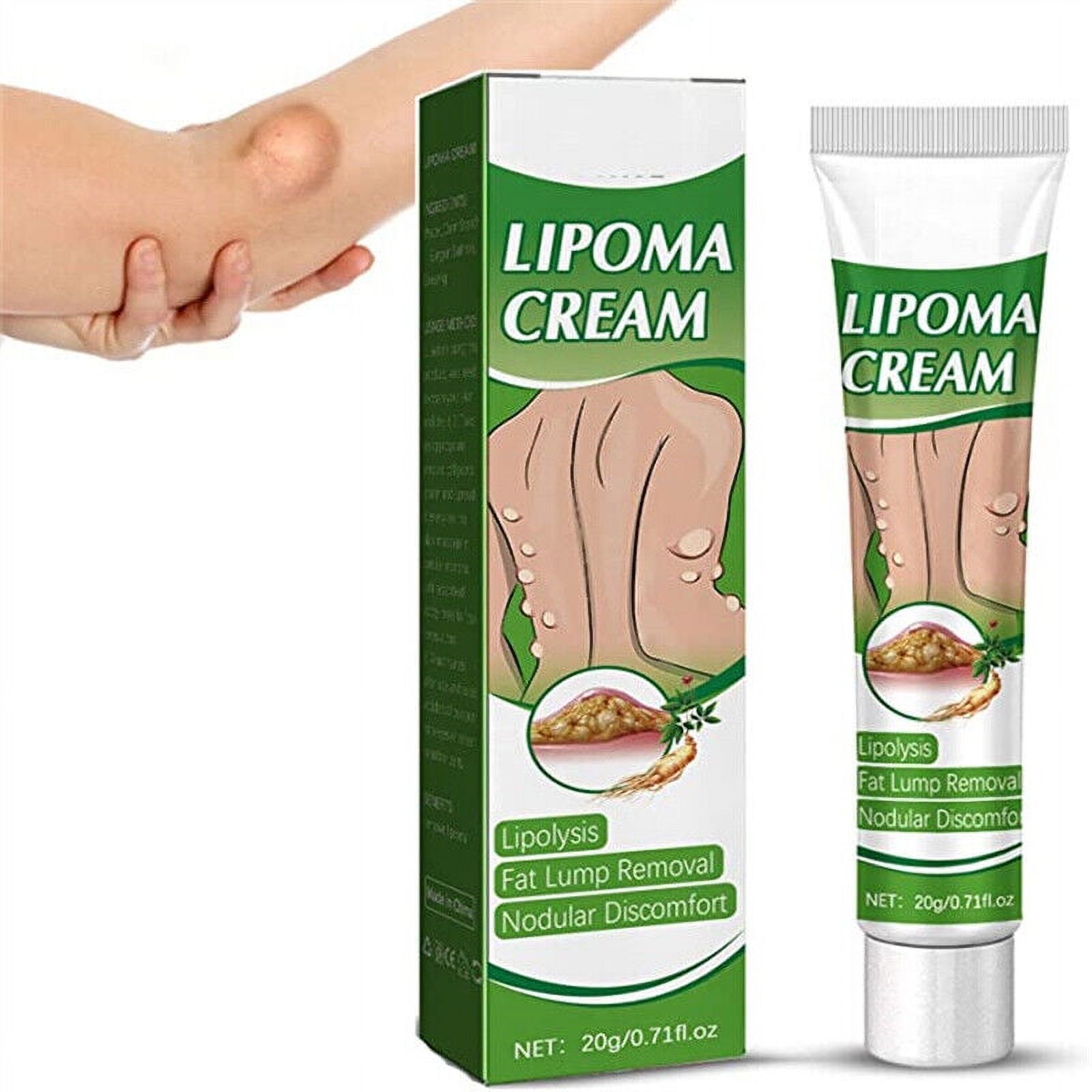 Lipoma Cure Soothing Ointment Lump Free Lipoma Removal Cream Fat Lump Removal