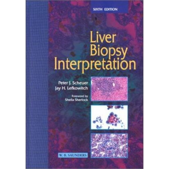 Pre-Owned Liver Biopsy Interpretation (Hardcover) 070202502X 9780702025020