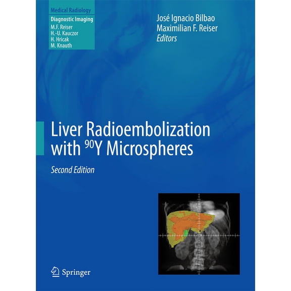 Liver Radioembolization with 90y Microspheres, (Hardcover)