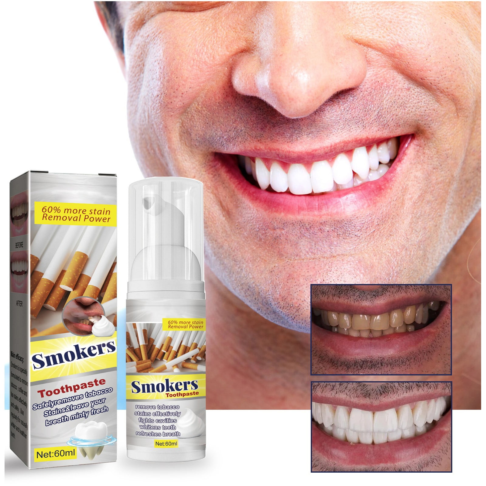 LoTiSee Cleaning Toothpaste To Remove Tooth Stains, Yellow Teeth