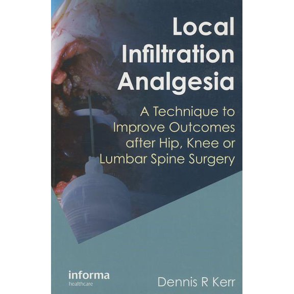 Local Infiltration Analgesia: A Technique to Improve Outcomes after Hip, Knee or Lumbar Spine Surgery, (Paperback)
