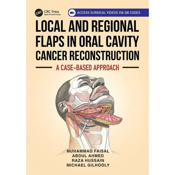 Local and Regional Flaps in Oral Cavity Cancer Reconstruction: A Case-Based Approach, (Paperback)