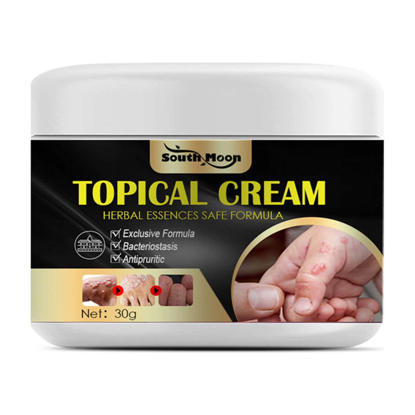Lomubue 30g Itchy Hands Cream Fast Absorbing Healthy Professional Anti