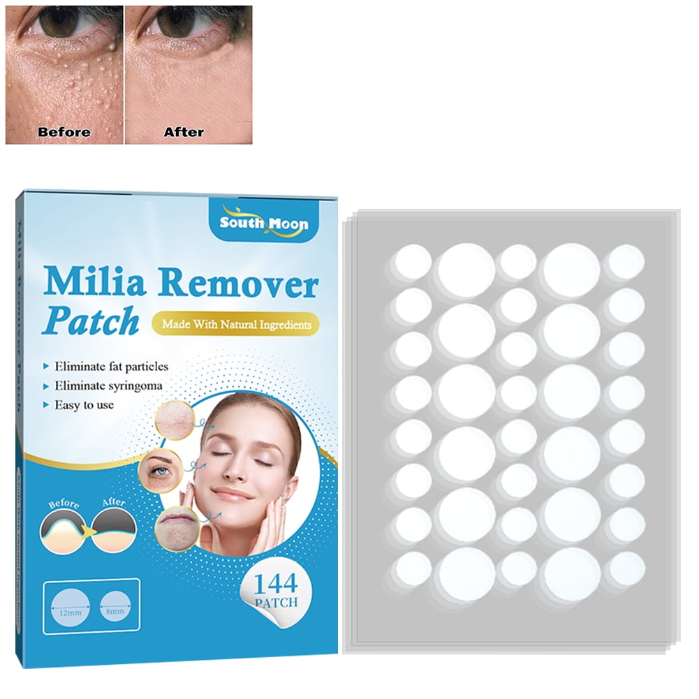 Lotpreco Milia Remover, 144pcs Milia Spot Treatment Patch Helps Dissolve and Reduce Milia, Syringomas, Cysts and Sebaceous Hyperplasia