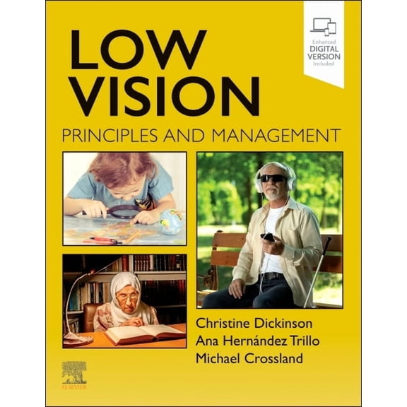 Low Vision: Principles and Management, (Paperback)