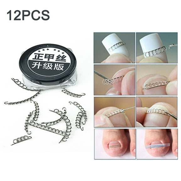 Ludlz 12Pcs Ingrown Toe Nail Correction Wire Pedicure Toenail Corrector Foot Care Tool