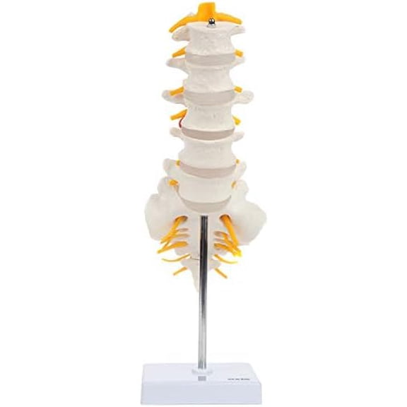 Lumbar Spine Anatomy Model with Sacrum and Spinal Nerves, Didactic Replica Demonstrates Lumbrosacral Section with Nerves and A Herniated Disc At L4 - Includes Base for Display and