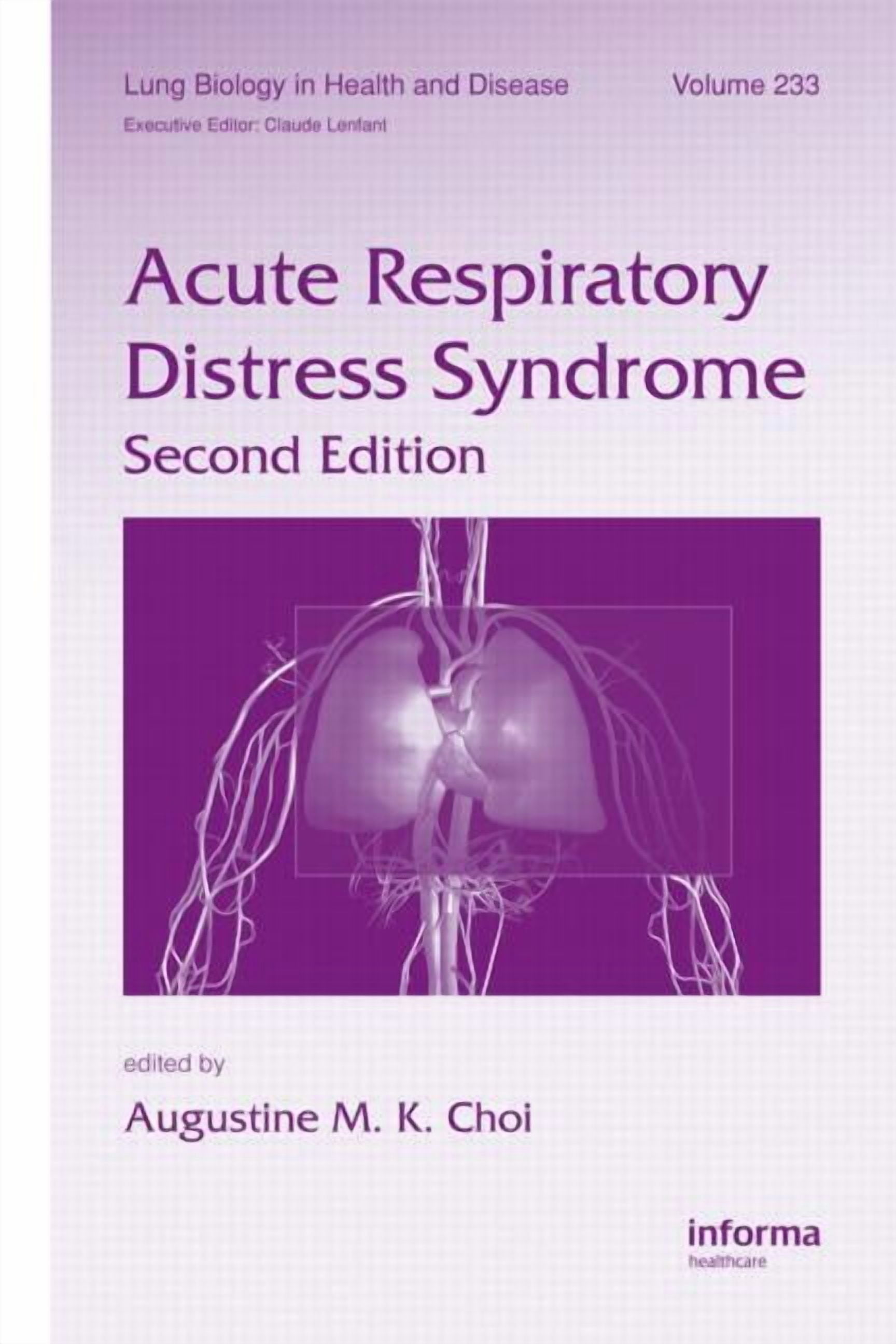 Lung Biology in Health and Disease Acute Respiratory Distress Syndrome ...