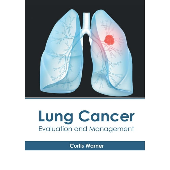 Lung Cancer: Evaluation and Management, (Hardcover)