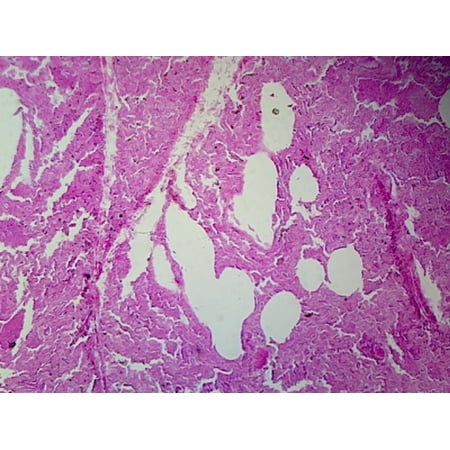 Lung, Human; Showing Alveoli; Section by Go Science Crazy