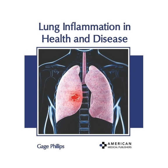 Lung Inflammation in Health and Disease, (Hardcover)