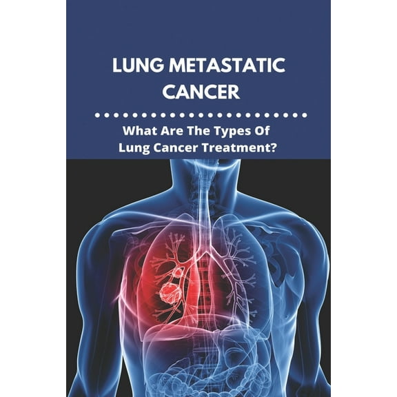 Lung Metastatic Cancer: What Are The Types Of Lung Cancer Treatment?: Stage 3 Lung Cancer (Paperback)