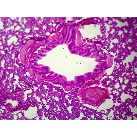 Lung Section by Go Science Crazy