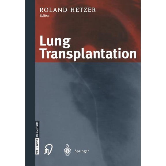 Lung Transplantation, (Paperback)